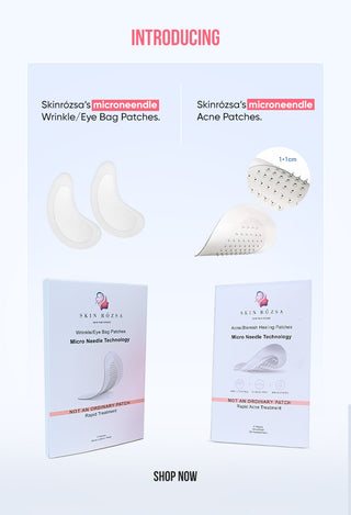 Skin Rózsa | Skin That Speaks